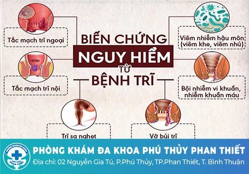 Bị trĩ sau sinh có nguy hiểm không?