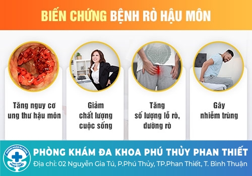 Rò hậu môn nguy hiểm như thế nào?
