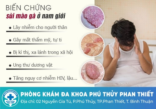 Sùi mào gà ở nam giới có nguy hiểm không?