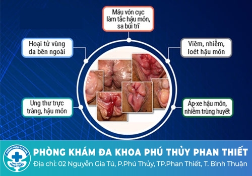 Đau rát hậu môn không cần điều trị có được không?