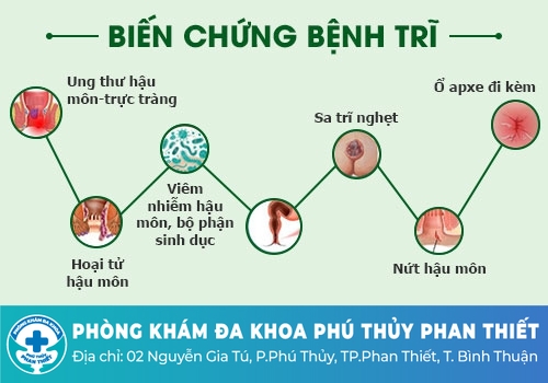Bệnh trĩ ngoại gây ra có nguy hiểm không?