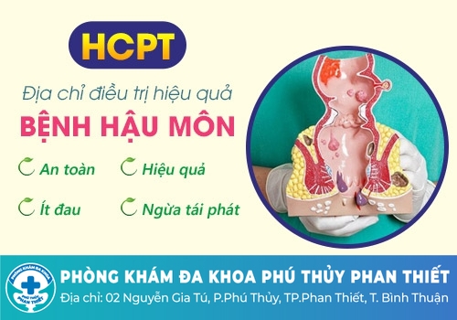 Mổ áp xe hậu môn ở đâu uy tín, hiệu quả?