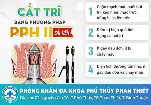 Điều trị trĩ nội ở đâu an toàn và hiệu quả?