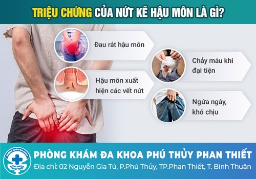 Nứt kẻ hậu môn có tự khỏi được không?