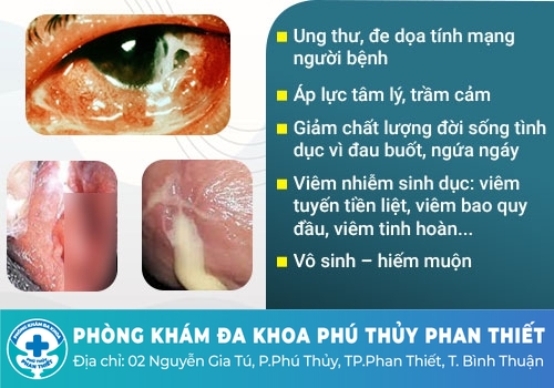Bệnh lậu có nguy hiểm không?