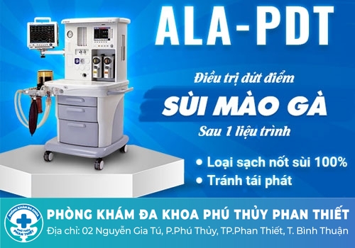 Cách điều trị cục thịt thừa âm đạo hiệu quả hiện nay