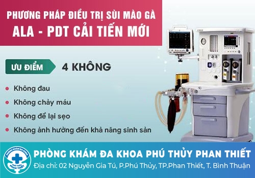 Sùi mào gà ở lưỡi điều trị như thế nào?
