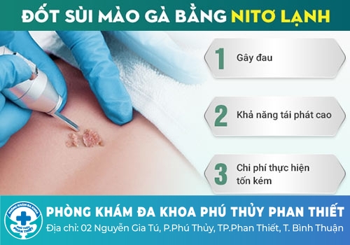 Điều trị sùi mào gà ở vùng kín bằng phương pháp đốt điện, đốt laser, áp lạnh