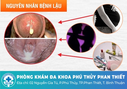 Nguyên nhân gây bệnh lậu