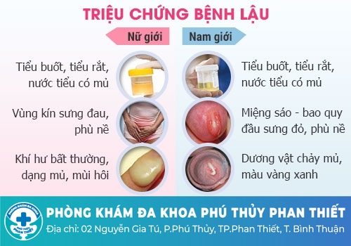 Tiểu buốt ra mủ là gì?
