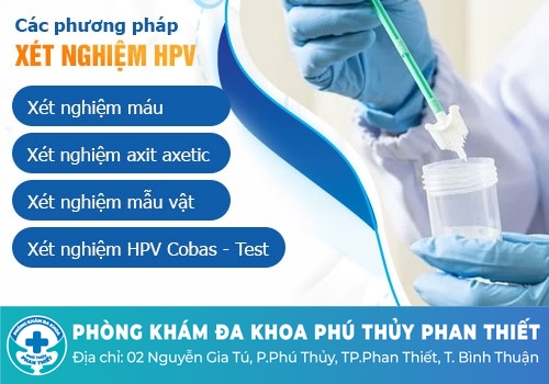 Xét nghiệm sùi mào gà ở đâu uy tín