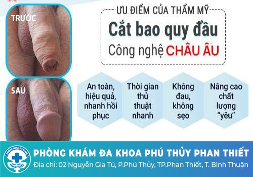 Những ưu điểm của phương cắt bao quy đầu bằng kỹ thuật xâm lấn tối thiểu