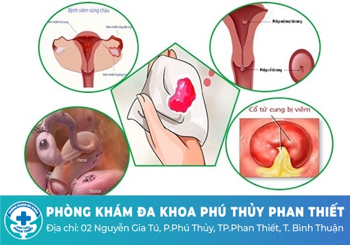 Chảy máu âm đạo bất thường có nguy hiểm không?
