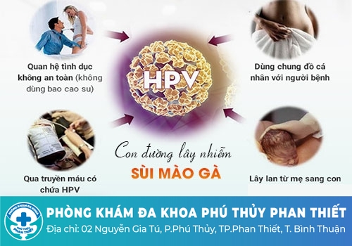 Nguyên nhân gây bệnh sùi mào gà ở vùng kín nữ giới là gì?