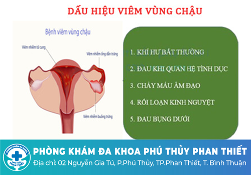 Ra khí hư như bã đậu do bệnh viêm vùng chậu