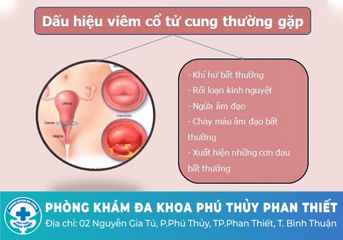 Viêm cổ tử cung là bệnh gì?