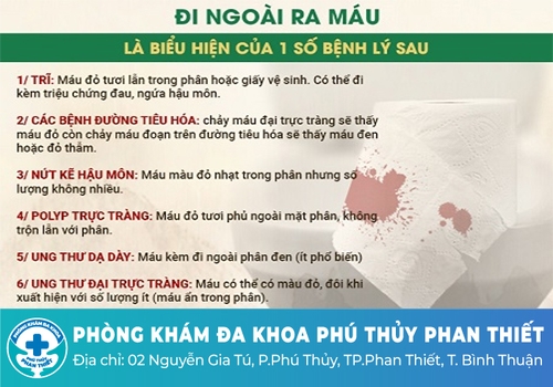 Nguyên nhân bị trĩ đi cầu ra máu là gì? 