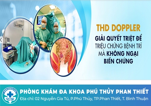 Chữa trĩ bằng phương pháp treo mạch THD không phẫu thuật
