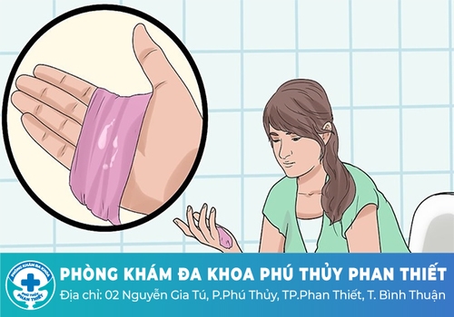 Nguyên nhân gây ra hiện tượng dịch âm đạo trắng sữa