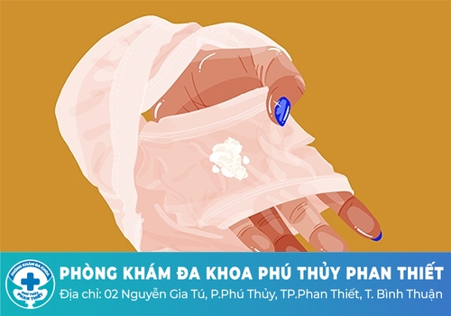 Nguyên nhân gây ra hiện tượng dịch âm đạo trắng sữa