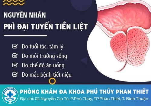 Nguyên nhân phì đại tuyến tiền liệt