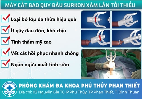 Phương pháp cắt bao quy đầu bằng kỹ thuật xâm lấn tối thiểu
