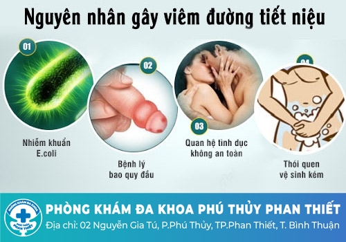 Nguyên nhân viêm đường tiết niệu ở nam giới