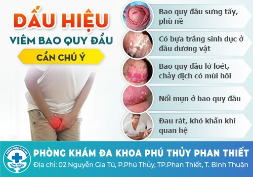Ngứa vùng kín ở nam giới do viêm bao quy đầu