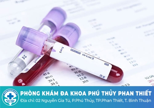 Xét nghiệm tổng quát máu cần lưu ý những gì?