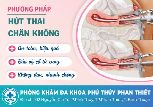 Cách bỏ thai an toàn bằng phương pháp hút thai chân không