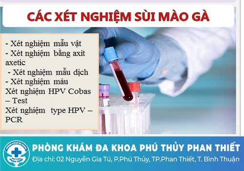 Các phương pháp xét nghiệm sùi mào gà chính xác hiện nay