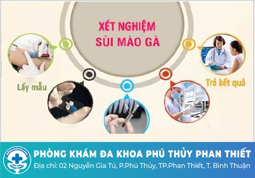 Quy trình xét nghiệm sùi mào gà