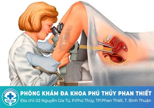 Soi cổ tử cung là gì?