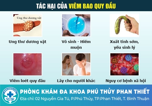 Những bệnh bao quy đầu thường gặp ở nam giới