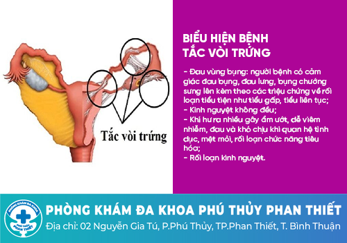 Các bệnh vùng kín nữ giới thường gặp phải 
