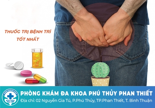 Điều trị bệnh trĩ ngoại độ 1 bằng phương pháp nào hiệu quả?