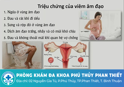 Nổi thịt thừa cửa mình do bệnh viêm âm đạo