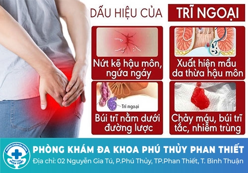 Trĩ ngoại độ 1 có tự hết không?