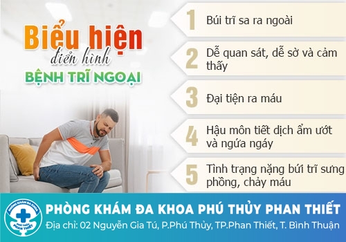 Đau tức hậu môn là bệnh gì – Bệnh trĩ ngoại