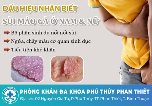Nổi mụn nước vùng kín do bệnh sùi mào gà