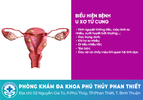Các bệnh vùng kín nữ giới thường gặp phải