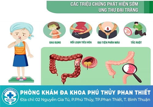 Đi cầu ra máu đỏ tươi do ung thư đại tràng