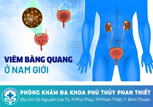 Nguyên nhân gây ra viêm bàng quang