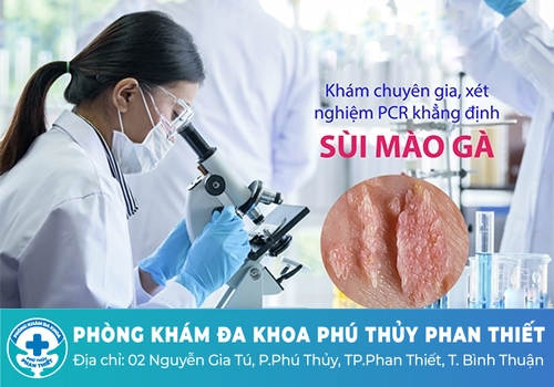 Chi phí khám sùi mào gà bao nhiêu tiền?