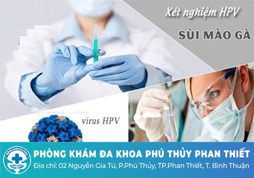 Xét nghiệm sùi mào gà bằng cách nào chính xác nhất?