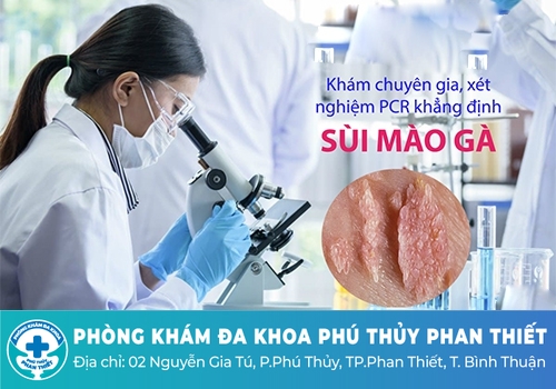 Xét nghiệm sùi mào gà bao nhiêu tiền?