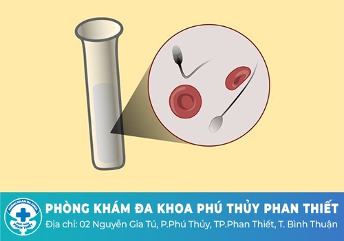 Tác hại của xuất tinh ra máu